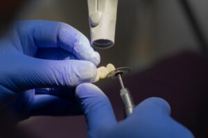 Older adult holding a toothbrush near dental model showing both an implant and a set of dentures