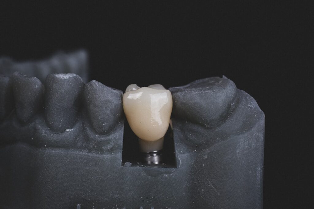 A dentist explains a dental implant using a plastic jaw model to an adult patient in a consultation room.