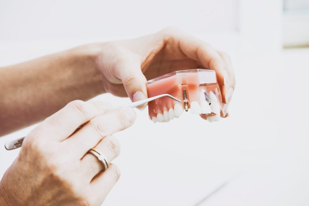 A close-up of a dental implant model showing the implant screw, abutment, and attached crown.