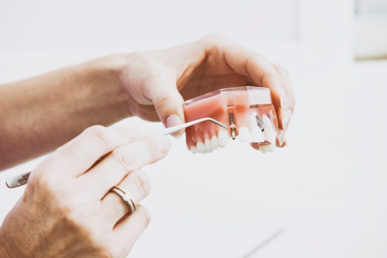 A close-up of a dental implant model showing the implant screw, abutment, and attached crown.