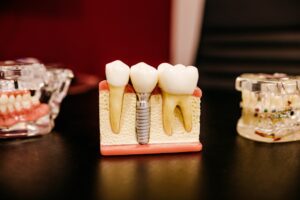 A dental professional reviews a patient's jaw X-ray with them in a bright, clean dental office.