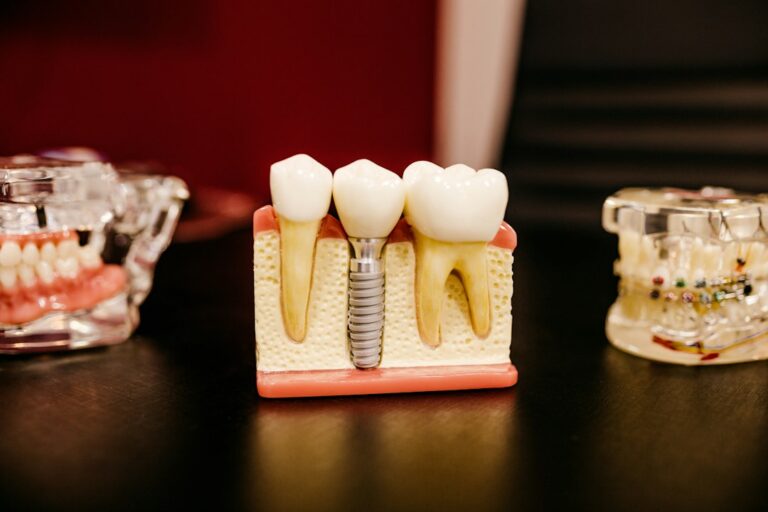Patient receiving a dental implant follow-up while a clinician examines healing gums and jaw imaging.